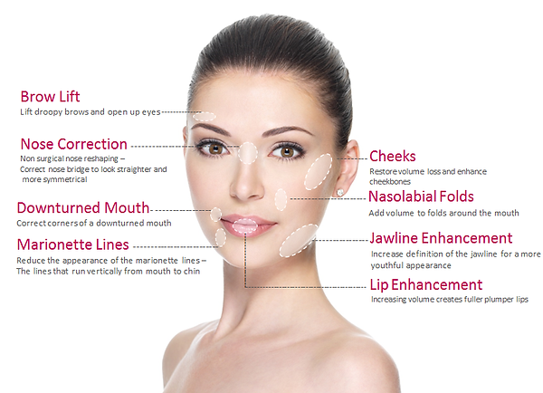 dermal filler injectables