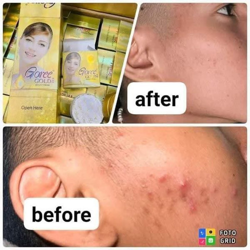 24 pieces beauty 美容クリーム Goree cream