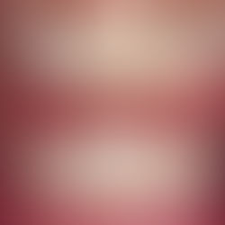 Invisalign First Success: A Smile Unlocked in Just 8 Months!