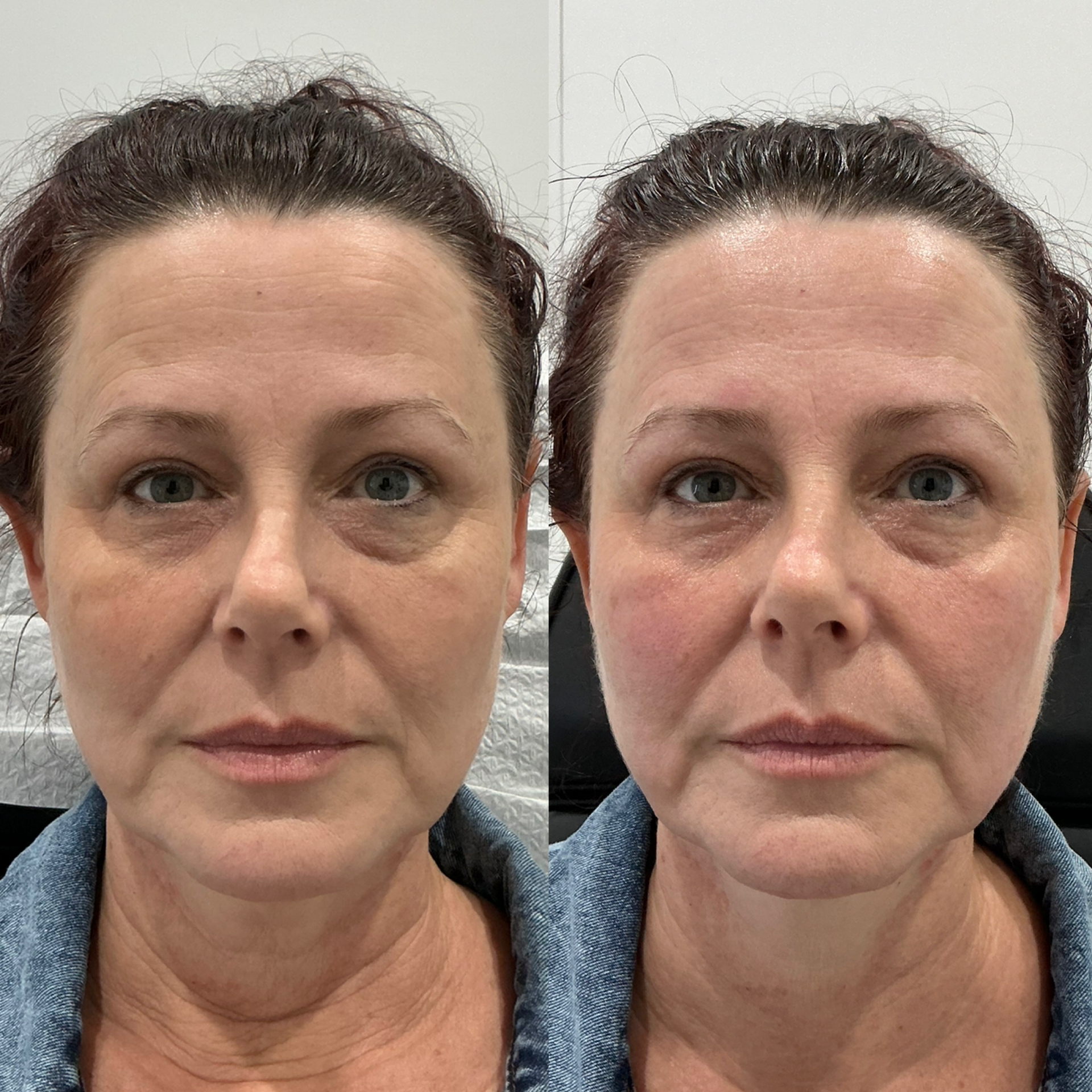 before after 2.jpeg