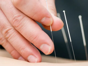 DİZ AĞRISI "Akupunktur" ile iyileşebilir.
