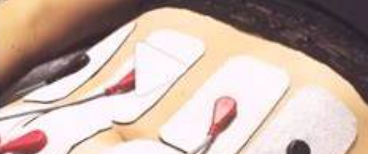 Neurotris_Bodylab Med Spa_Ab treatment.png