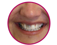 dental_casetudy6.png