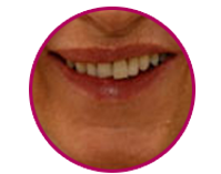 dental_casetudy9.png