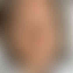 Inainte de procedura Oxygenera Pro - Anca Cosmetics Studio