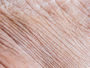 Îmbătrânirea pielii este un proces natural, inevitabil, dar modul în care acest proces se manifestă diferă enorm de la o persoană la alta. Deși genetica joacă un rol important, studiile și experiența clinică arată clar că stilul de viață este factorul decisiv care influențează rapiditatea și profunzimea îmbătrânirii pielii. Cu alte cuvinte, nu doar vârsta din buletin contează, ci mai ales modul în care ne trăim viața zi de zi.