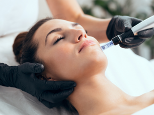 Microneedling în sezonul cald: Ce trebuie să știi despre protecția post-tratament