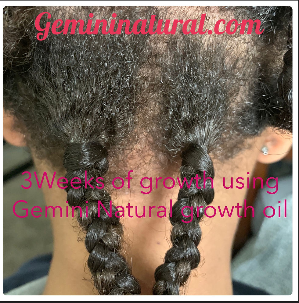 Thumbnail: Gemini Twin Hair Growth Oil