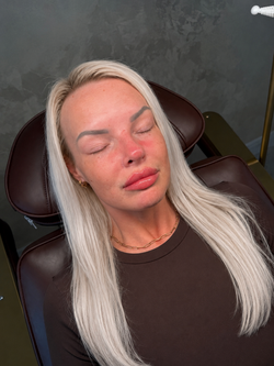Lip Enhancement