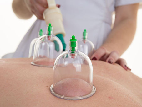 Hacamat Vücutta Hangi Noktalara Uygulanır?