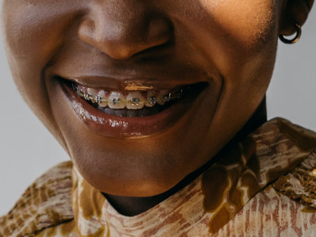 Braces: Do's & Don'ts 