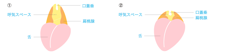 ひらざわクリニック 睡眠時無呼吸症の診断