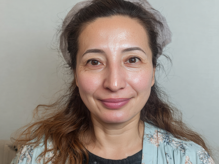 half face lift effect