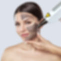 carbon-laser-peeling-zurich.jpg