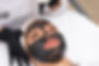 hollywood-carbon-peel-2-1024x683.jpeg