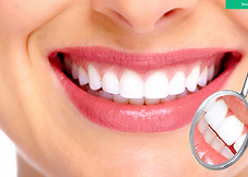 Teeth Whitening - San Leandro CA.png