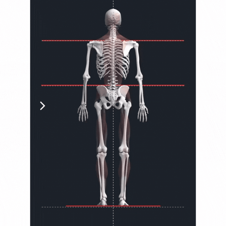 Spinal Misalignment Animation Elite Upper Cervical Dr. Corey Burt.gif