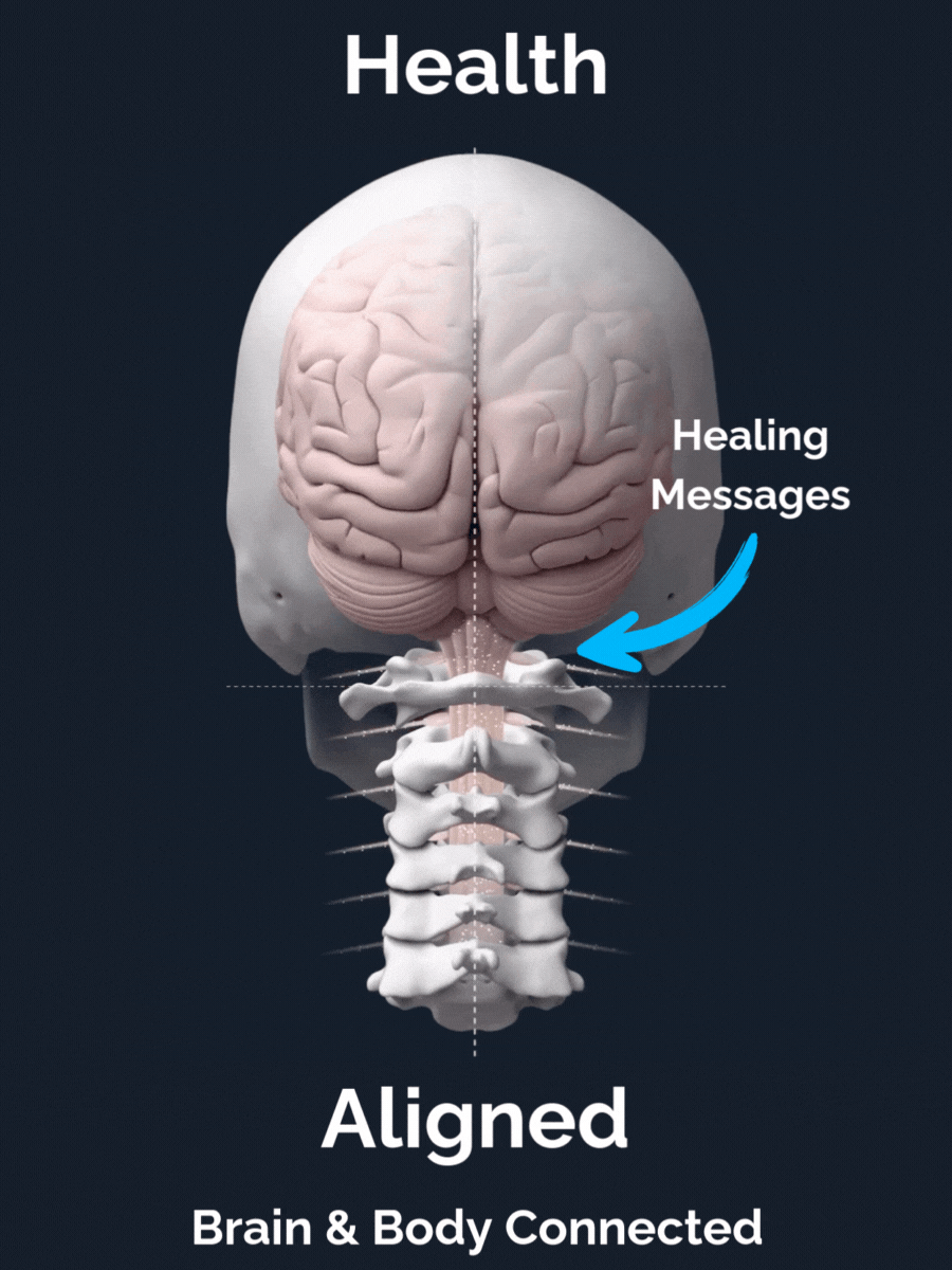 Elite upper cervical Aligned Atlas.gif