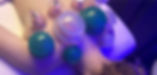 cupping therapy.jpg