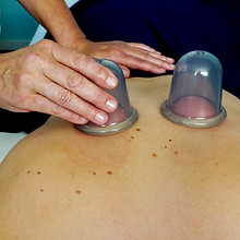 Praktijk Heike Plomp - Cupping