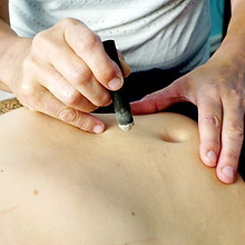 Praktijk Heike Plomp - Moxa therapie