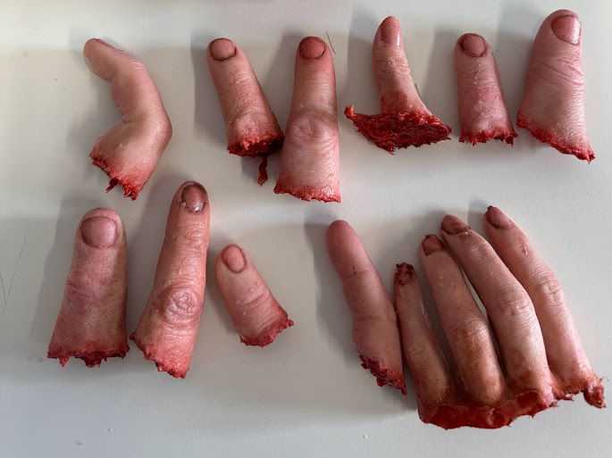 severed fingers