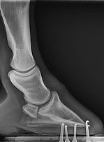 X-ray
