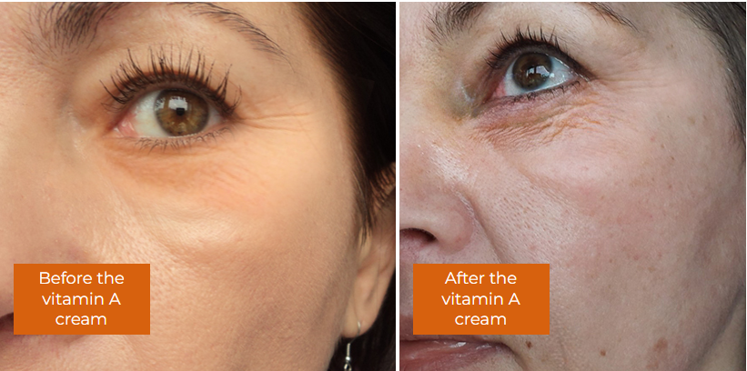 Rechiol for face Problem Rechiol per il problema del viso