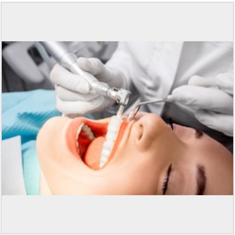 ODONTOLOGIA CONSERVADORA