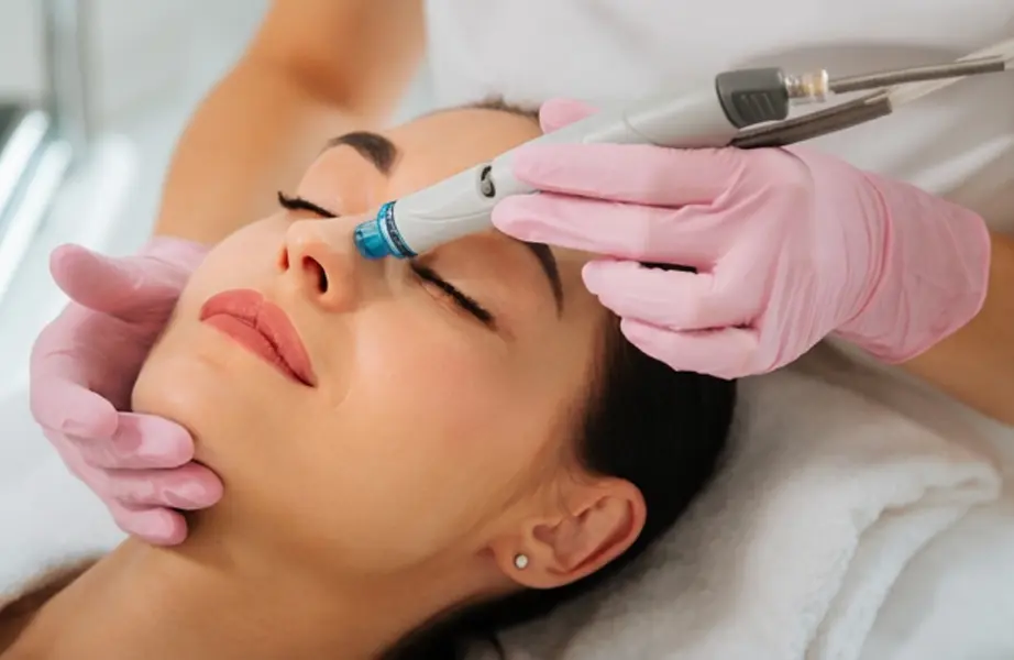 Kosmetikerin führt eine RF-Needling-Behandlung im Gesicht einer Kundin zur Hautstraffung und Verfeinerung des Hautbildes durch.