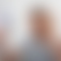 Types of Hair Loss: Understanding the Different Causes and Treatment