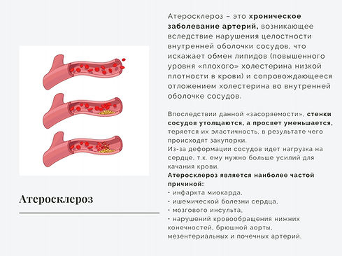 7a9a410c3e974640d6f7c7eb8fa523df4Sof33ZQ