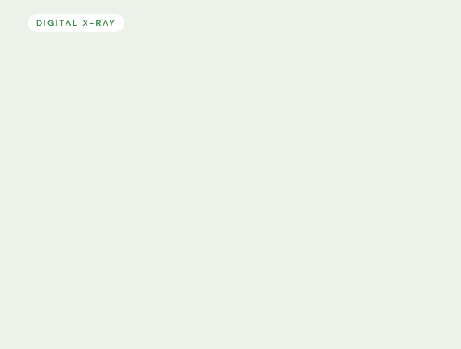 Digital X-rays