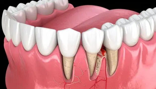 Mental Health and Oral Wellbeing: The Overlooked Connection