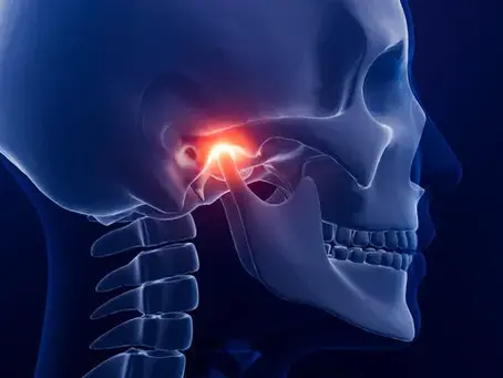 How Missing Teeth Can Lead to TMJ Pain | Oyster Dental Care
