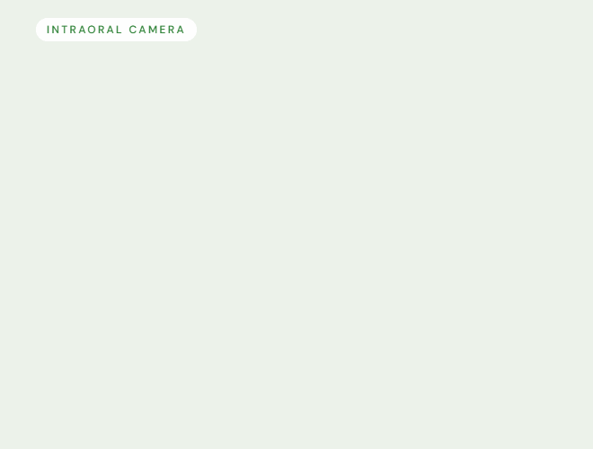 Intraoral cameras