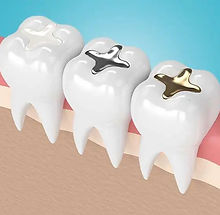 Expert dental care for a healthy and confident smile, Painless and affordable care