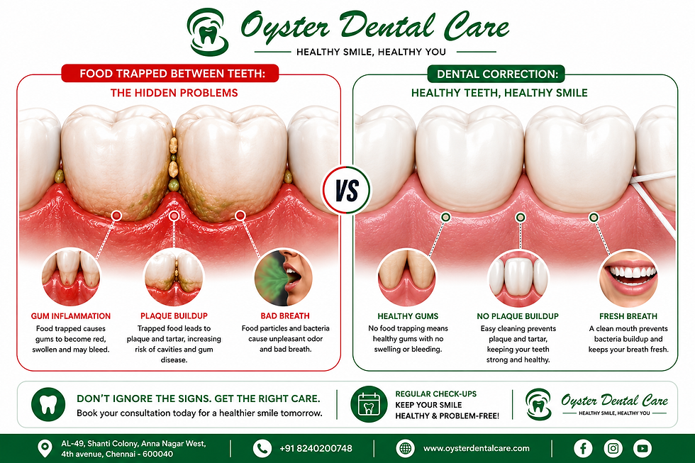 food getting stuck between teeth, food trapping between teeth, why food gets stuck between teeth, gap between teeth food stuck, gum recession food trapping, cavity between teeth symptoms, worn filling food trap, Oyster Dental Care Chennai, best dentist Anna Nagar Chennai, dentist in Shanti Colony Chennai