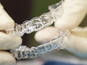 Clear Aligners vs Braces: Which Is Right for You?