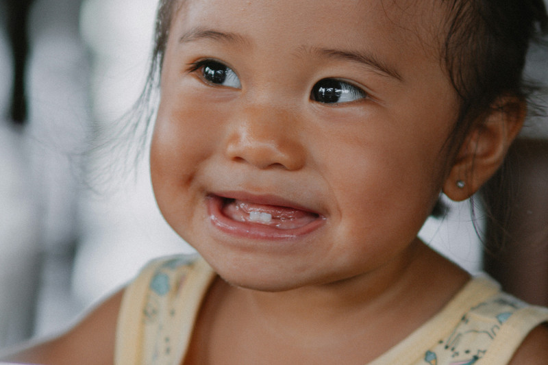 Bottle Feeding & Cavities: What Parents Often Miss About Baby Tooth