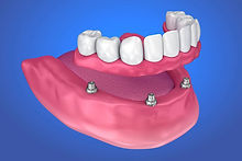 Expert dental care for a healthy and confident smile, Painless and affordable care