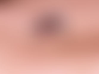 Nota Oficial: Jundiaí confirma terceira morte por dengue em 2025