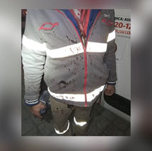 Trabalhador é agredido com barra de ferro durante serviço de telefonia em Jundiaí