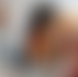 Prefeitura de Jundiaí e FMJ realizam atendimentos gratuitos contra o câncer de pele neste sábado (13)