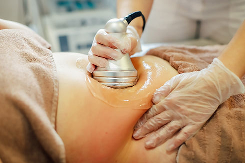 cavitation on the body