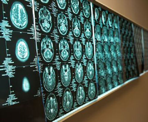 Neurology Center Of Arizona Neurology Center Of Arizona