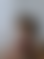 Healing Trauma with Evidence-Based Approach for PTSD Recovery