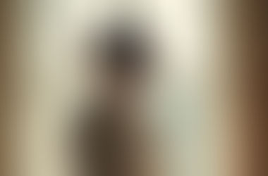 Body Dysmorphic Disorder (BDD) 
