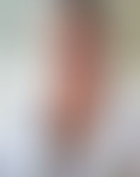 Overeating Or Binge Eating: How To Tell The Difference