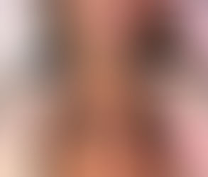 Tips To Botox Around Eyes Houston TX: Cosmetic Wrinkle Filler